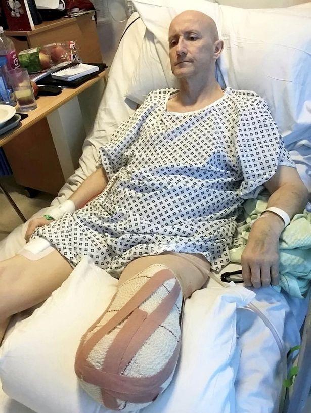 После вакцинации AstraZeneca экс-чемпиону мира по тхэквондо Дэйву Мирсу пришлось ампутировать ногу