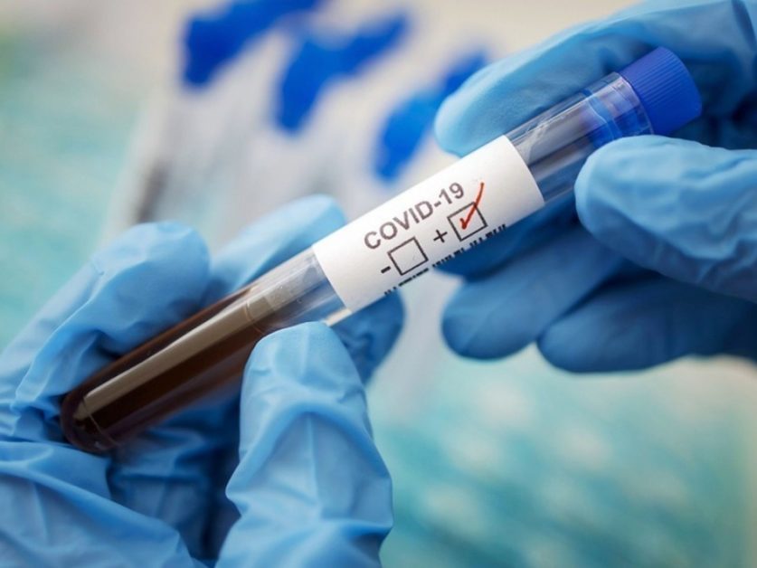 В США коронавирус обогнал «испанку» в смертоносности